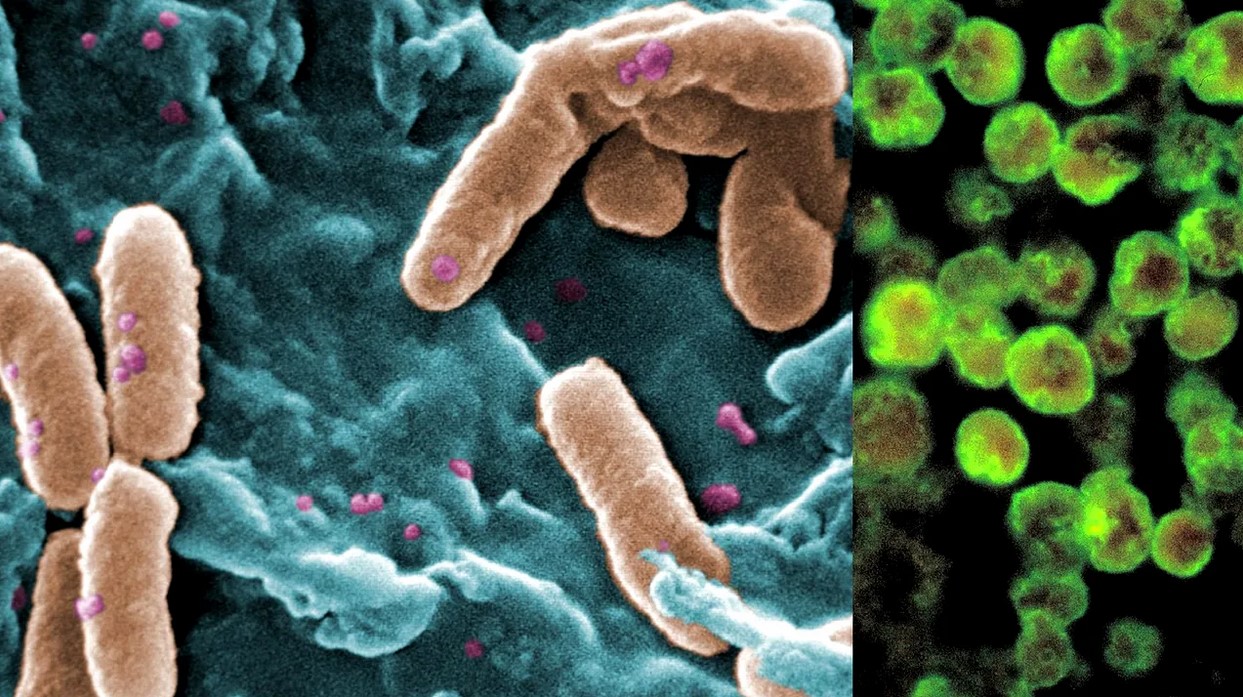 epidemie de holera in nigeria 58 de decese 250 de infectati