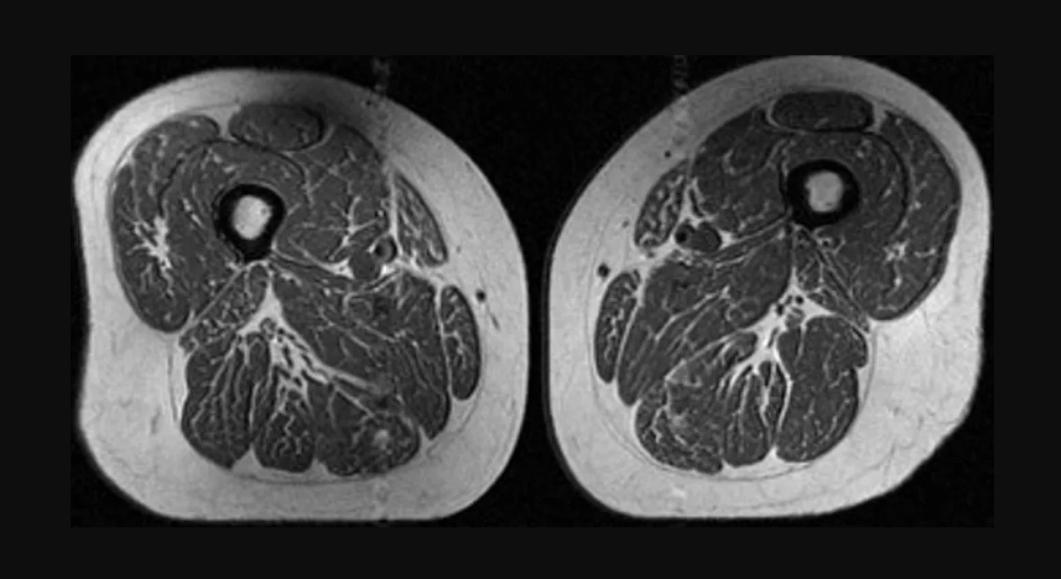 Alimentele ultraprocesate transforma muschii in grasime avertisment dintr un nou studiu
