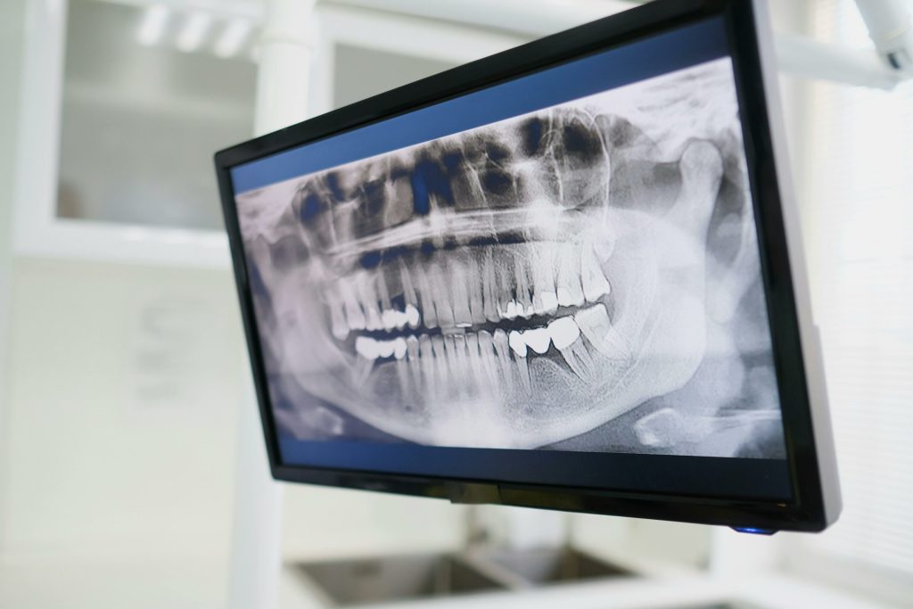 De ce dintii nu sunt oase Principala diferenta dintre cele doua categorii